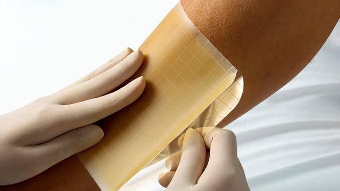 ATUAÇÃO DA ENFERMAGEM: QUANDO USAR OS CURATIVOS ESPECIAIS NO TRATAMENTO DE FERIDAS